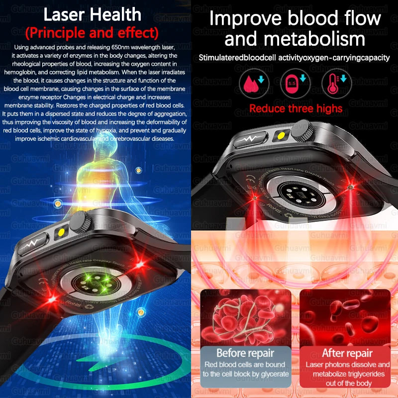 New Laser Treatment Three High Smart Watch Men ECG Heart Rate Uric Acid Health Tracker 1.95 inches Sapphire Glass SmartBracelet